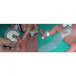 bolsas-recogida-orina-pediatrica-corysan-12-uds